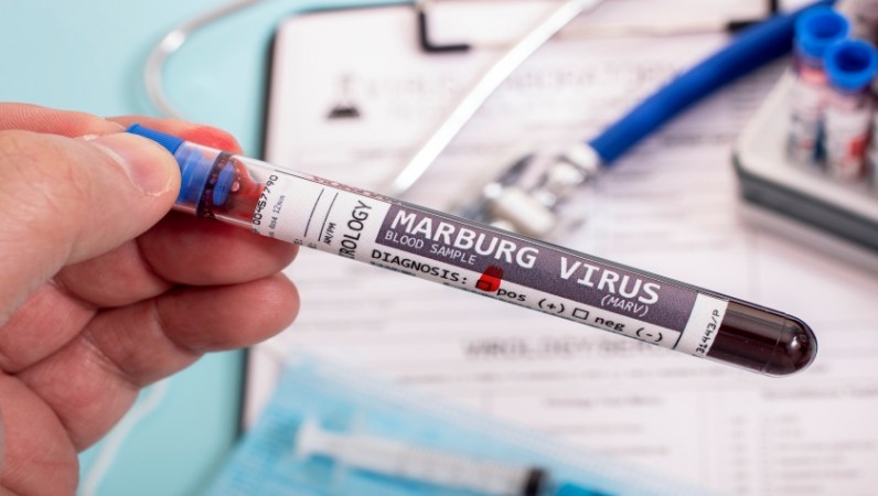 Tanzania reports its first case of Marburg Virus  with a High Fatality Rate