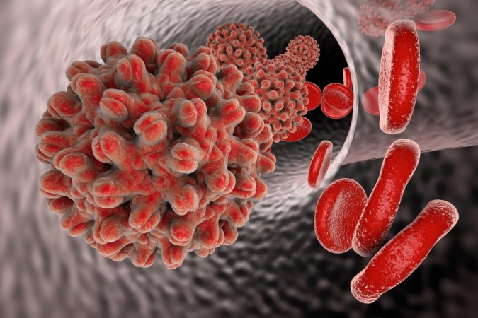 Study Reveals Alarming Lack of Africa Representation in Hepatitis B Clinical Trials